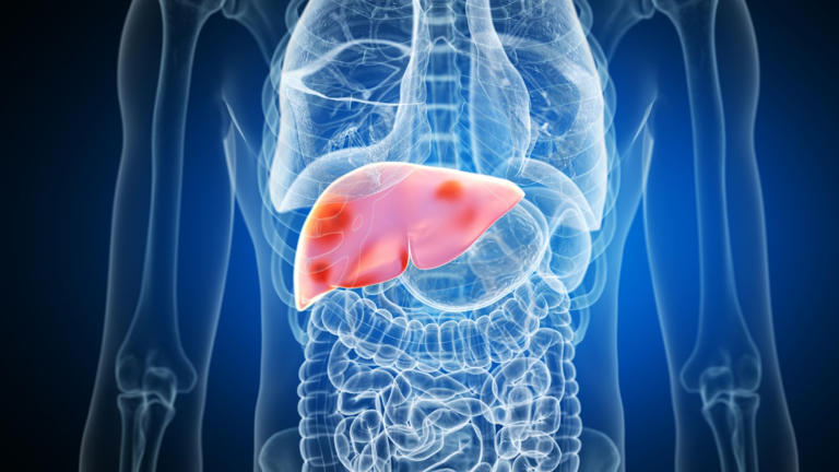 10 foods to help you maintain a healthy liver