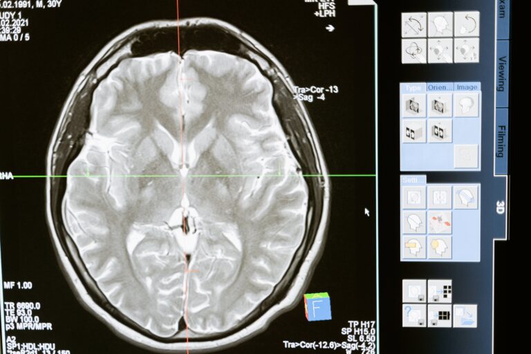 “All About Elon Musk’s Neuralink and Its First Human Brain Implant.”